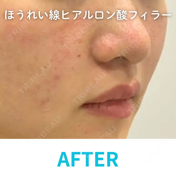 DIAV（ディアブ） クリニック クォン・オスン医師の症例