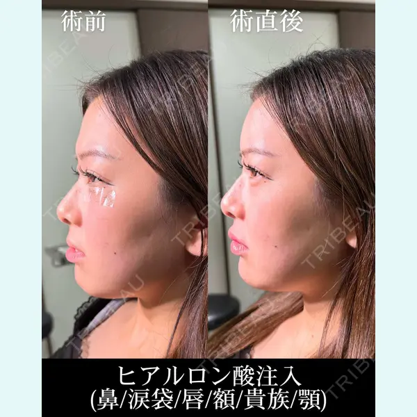 HAAB×DREAM BEAUTY CLINIC 大阪梅田院 錦 実奈医師の症例