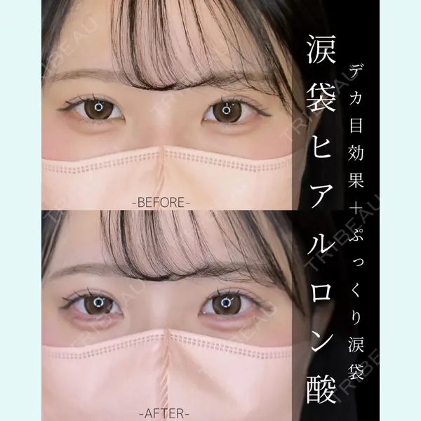 ルラ美容クリニック 大宮院 / ルラスキンクリニック 大宮院 右京 大季医師の症例