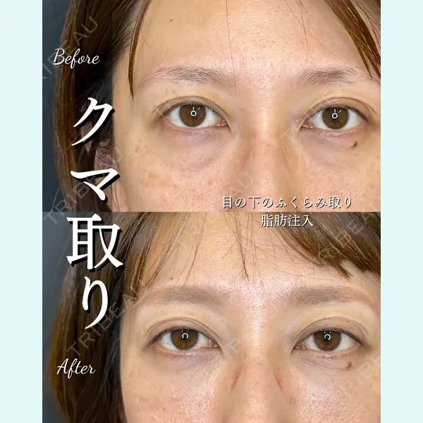 ルラ美容クリニック 大宮院 / ルラスキンクリニック 大宮院 右京 大季医師の症例