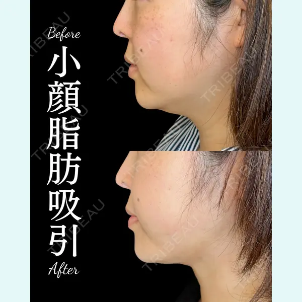 ルラ美容クリニック 大宮院 / ルラスキンクリニック 大宮院 右京 大季医師の症例