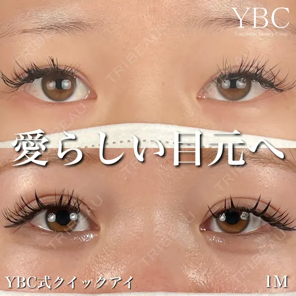 YBC横浜美容外科 大宮院 磯村 亮輔医師の症例