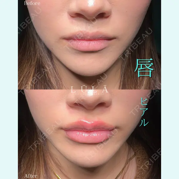 ルラ美容クリニック 町田院 松岡 舟作医師の症例