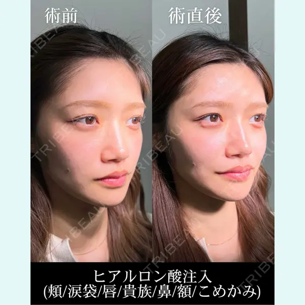 HAAB×DREAM BEAUTY CLINIC 大阪梅田院 錦 実奈医師の症例