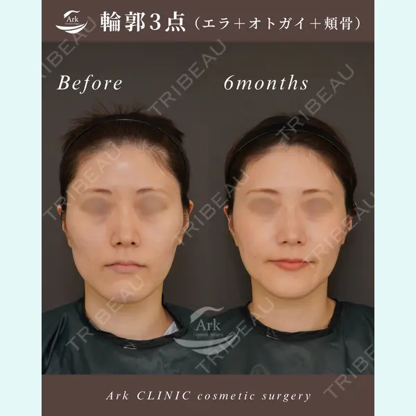 アーククリニック 加藤 雄大医師の症例