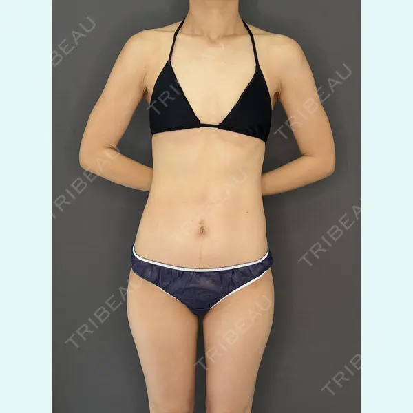 東京美容外科 熊本院 峯 純恵医師の症例