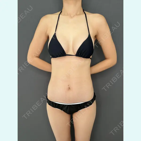 東京美容外科 熊本院 峯 純恵医師の症例