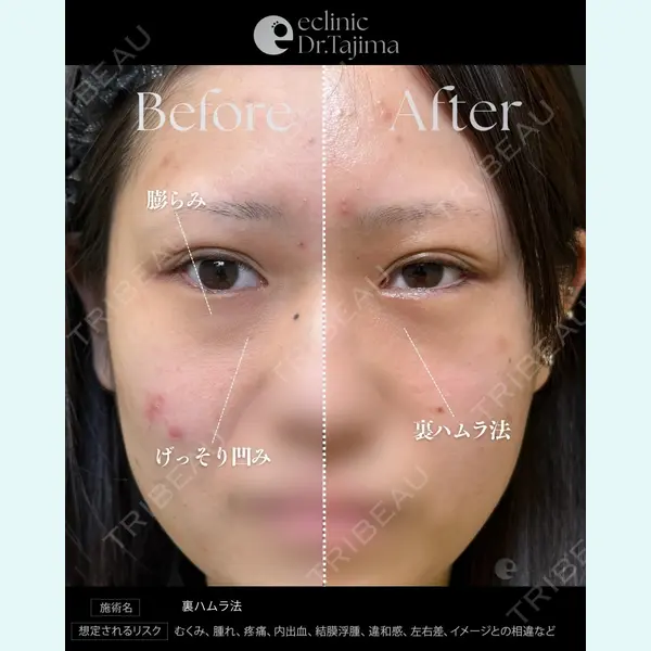 eクリニック 岡山院 田嶋 隼也医師の症例