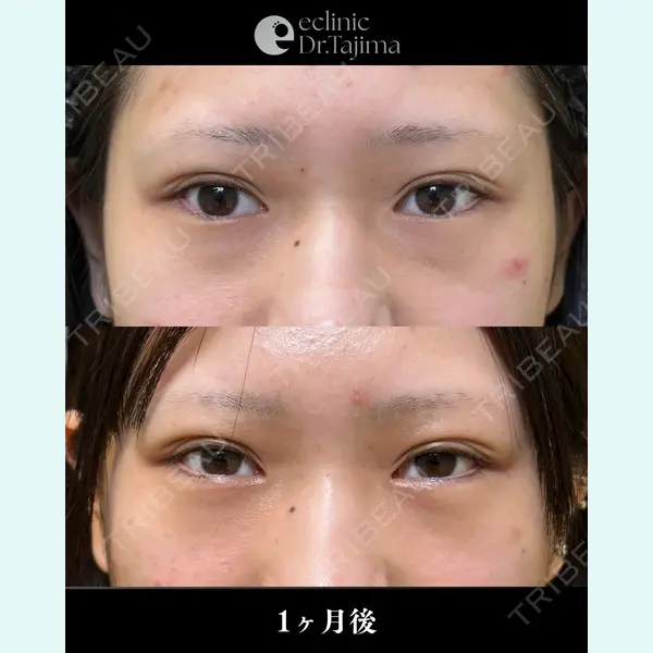 eクリニック 岡山院 田嶋 隼也医師の症例