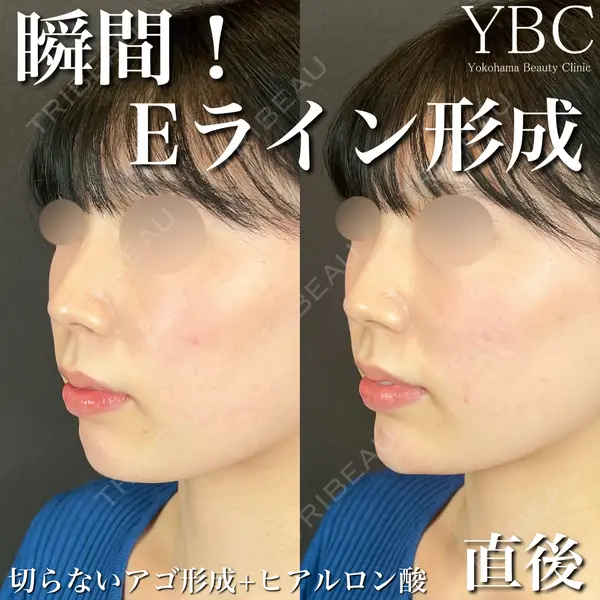 YBC横浜美容外科 立川院の症例