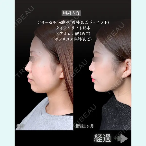 東京シンデレラ美容外科 池袋院 石井 達也医師の症例