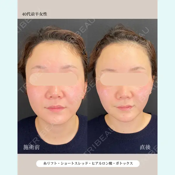 自由が丘ウェルエイジングビューティークリニック 福田 知佐子医師の症例