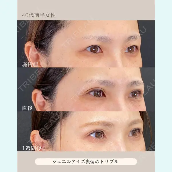 自由が丘ウェルエイジングビューティークリニック 福田 知佐子医師の症例