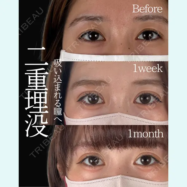 ネビュラクリニック 東京錦糸町院 岩切 琢磨医師の症例