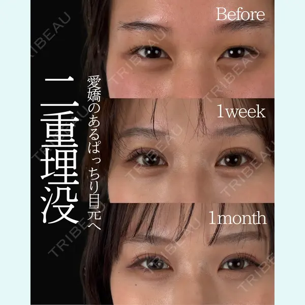 ネビュラクリニック 東京錦糸町院 岩切 琢磨医師の症例