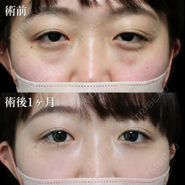 NARU Beauty Clinic 【ナルクリ】 倉津　諭医師の症例