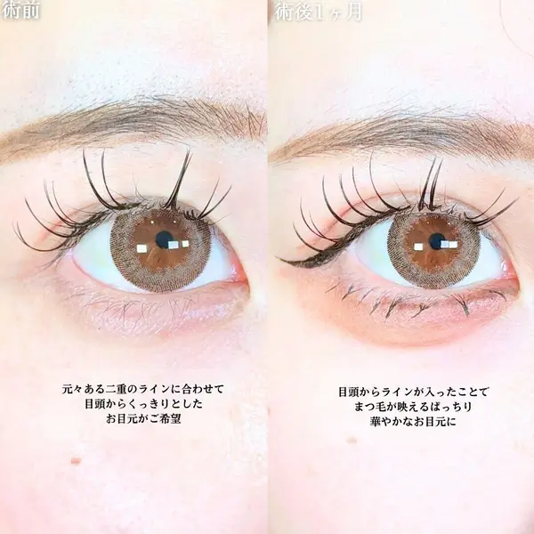 アリエル美容クリニック 大宮院 江郷隼一郎医師の症例