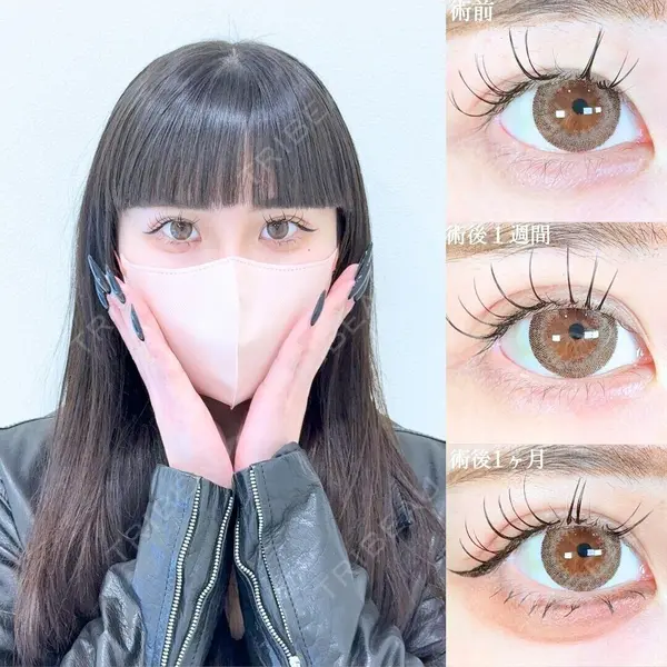 アリエル美容クリニック 大宮院 江郷隼一郎医師の症例