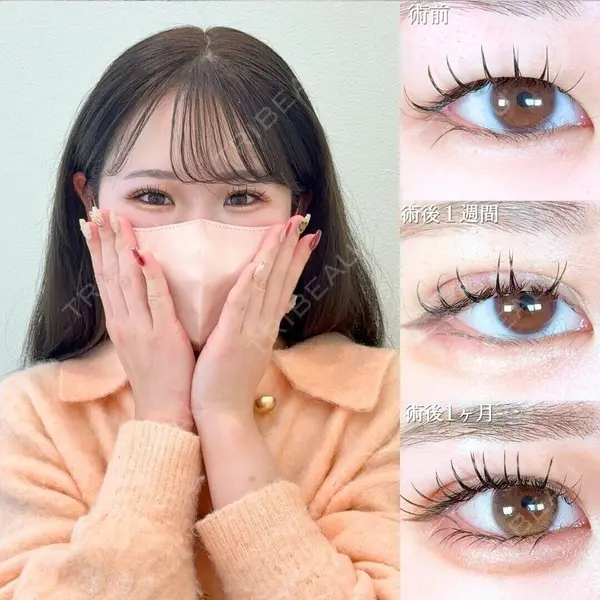 アリエル美容クリニック 大宮院 鈴木　桂介医師の症例