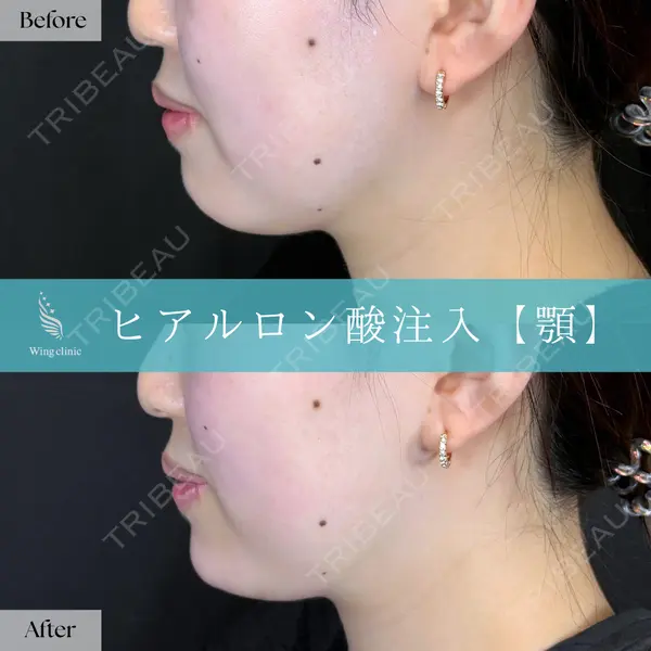 Wing clinic 豊中駅前院 速水 翼医師の症例