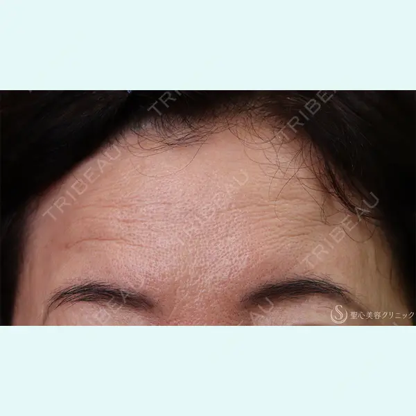 聖心美容クリニック 横浜院 佐々木 直美医師の症例