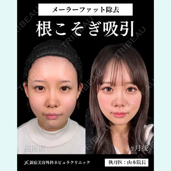 新宿美容外科ネビュラクリニック 山本 紘子医師の症例