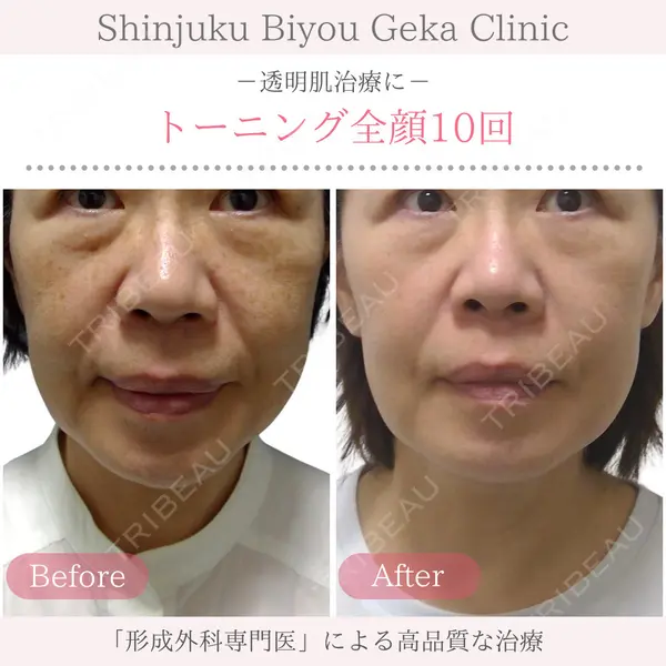 新宿美容外科クリニック 立川院の症例