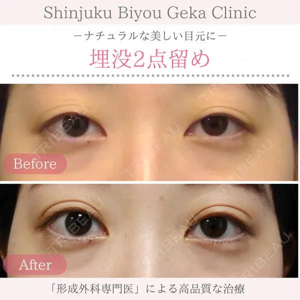 新宿美容外科クリニック 立川院の症例