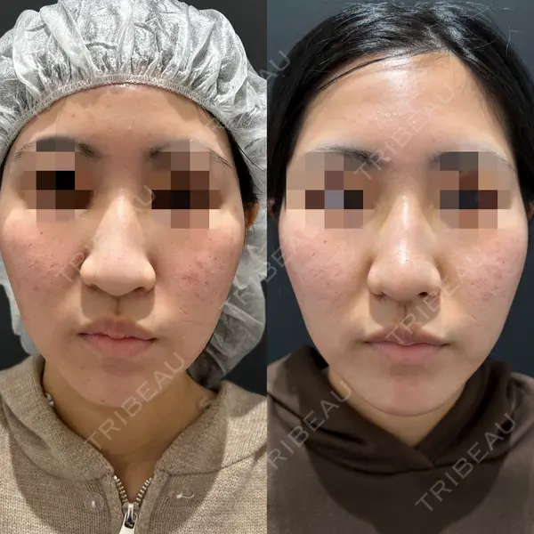 エターナル美容クリニック 久門田 詳医師の症例