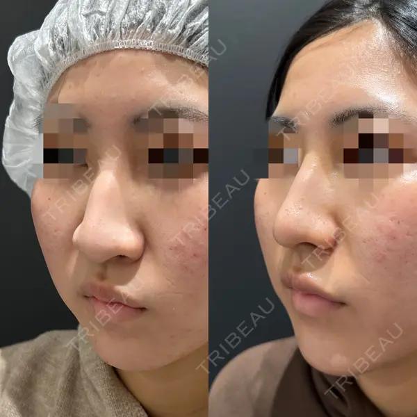 エターナル美容クリニック 久門田 詳医師の症例