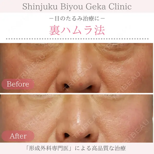 新宿美容外科クリニック 立川院の症例