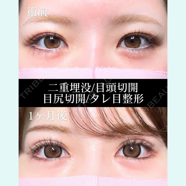 HAAB×DREAM BEAUTY CLINIC 大阪梅田院 鈴木 馨斗医師の症例