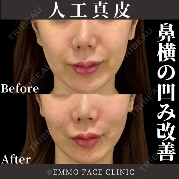 EMMO FACE CLINIC 東京三田院 木之下 哲彦医師の症例
