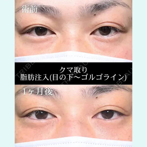 HAAB×DREAM BEAUTY CLINIC 大阪梅田院 鈴木 馨斗医師の症例