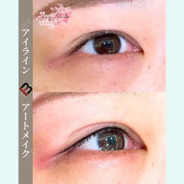 筋肉・美容クリニック 大野笑加（アートメイク）医師の症例