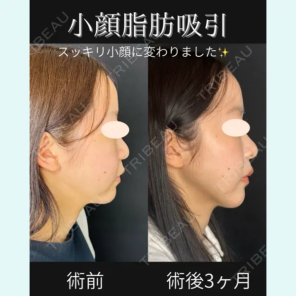 ルラ美容クリニック 仙台院 / ルラスキンクリニック 仙台院 橋本 英樹医師の症例