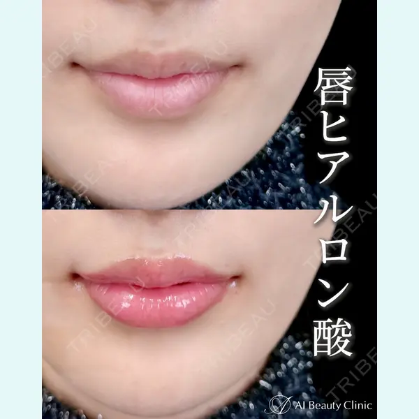 AI Beauty Clinic （エーアイ美容クリニック） 尾崎 宥文医師の症例