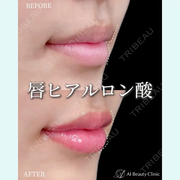 AI Beauty Clinic （エーアイ美容クリニック） 尾崎 宥文医師の症例