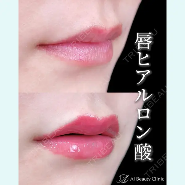 AI Beauty Clinic （エーアイ美容クリニック） 尾崎 宥文医師の症例