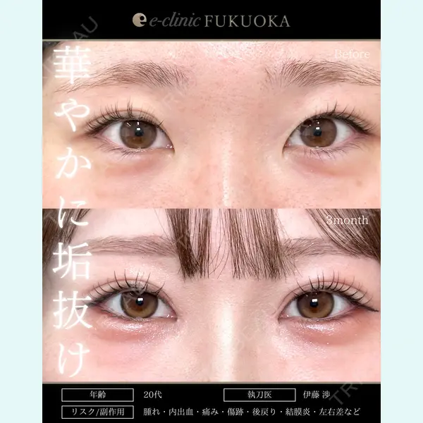 eクリニック 福岡院 伊藤 渉医師の症例