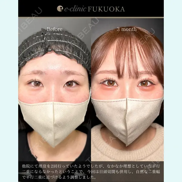 eクリニック 福岡院 伊藤 渉医師の症例