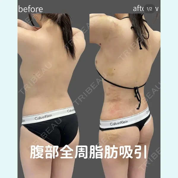 plume clinic 向山 綾子医師の症例