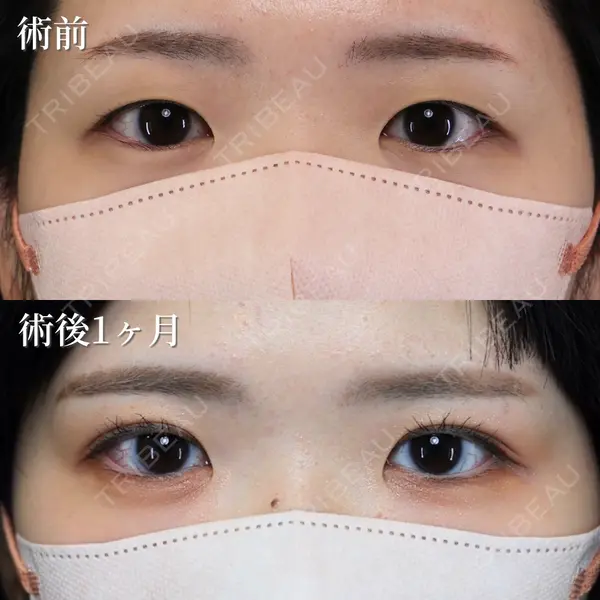 NARU Beauty Clinic 【ナルクリ】 石橋 成彦医師の症例