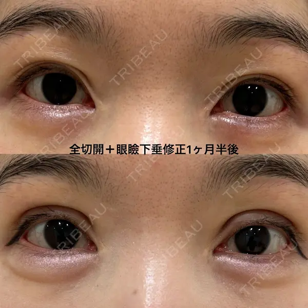 エターナル美容クリニック 久門田 詳医師の症例