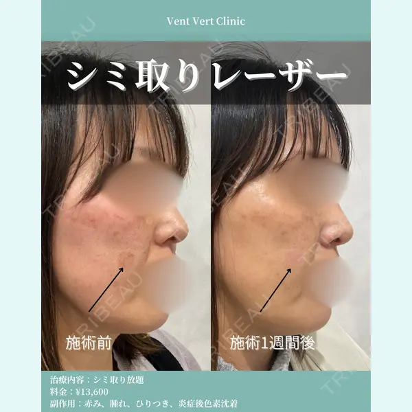 ヴァンヴェールクリニック 高槻院 李 愚姫医師の症例