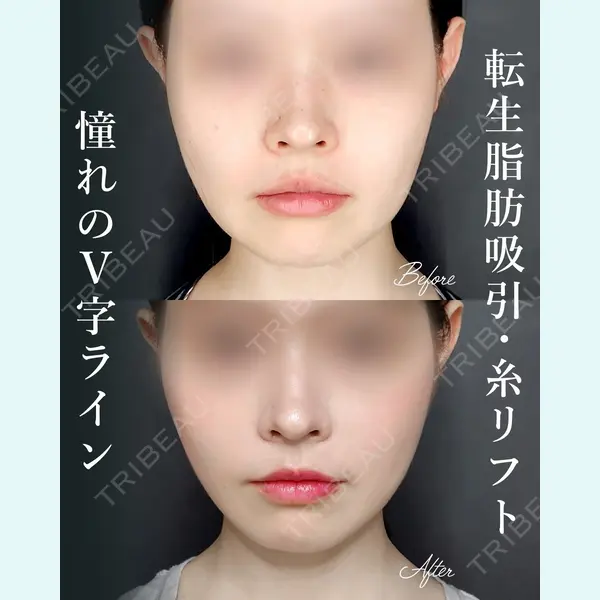 Tokyo Tensei Clinic 新宿院 桂田 凛医師の症例