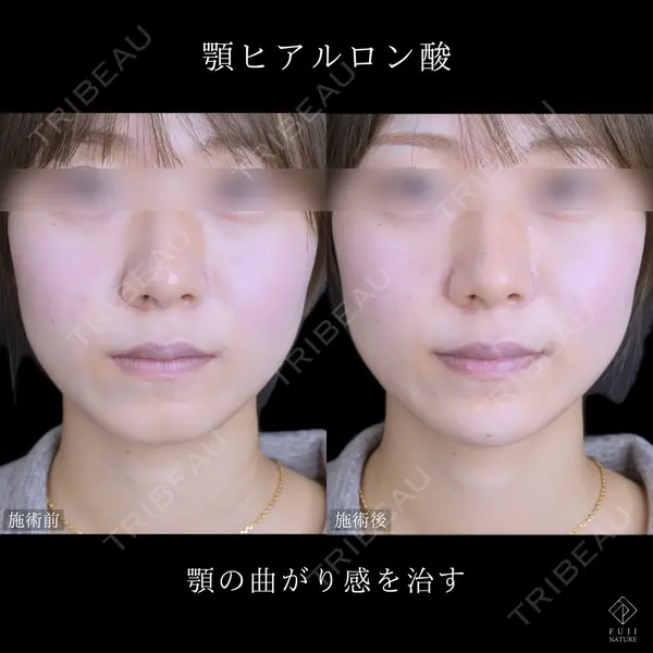 藤・ナチュレ美容クリニック 銀座院 小川 杏平医師の症例