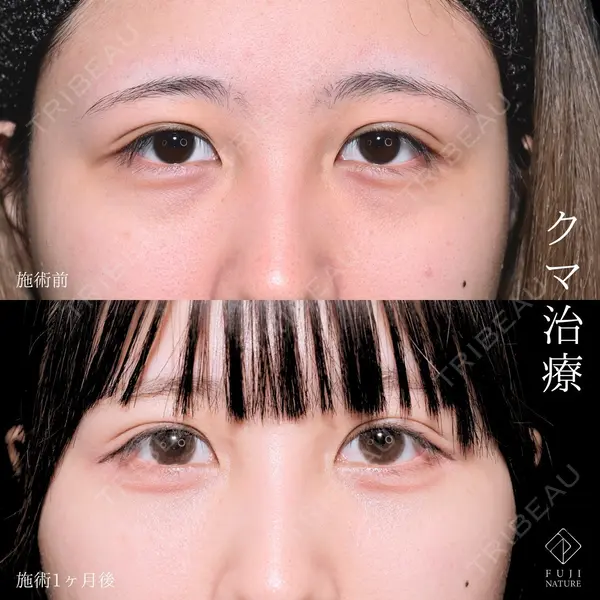 藤・ナチュレ美容クリニック 銀座院 小川 杏平医師の症例