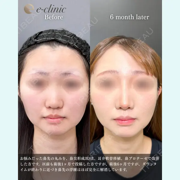 eクリニック 福岡院 伊藤 渉医師の症例