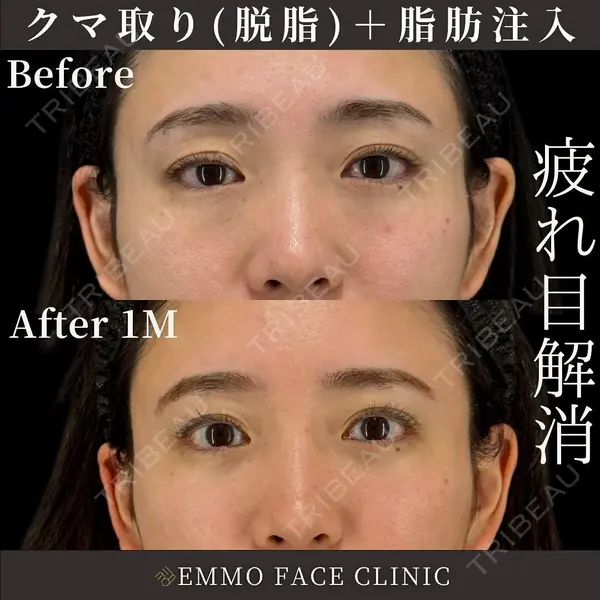 EMMO FACE CLINIC 東京三田院 木之下 哲彦医師の症例